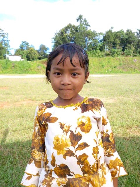 World Vision India